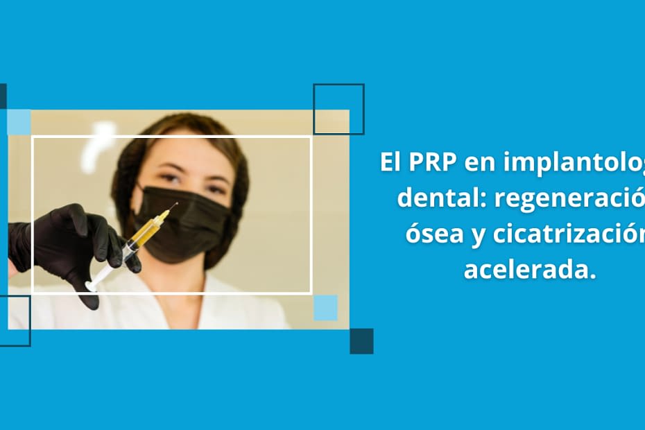 El PRP en implantología dental regeneración ósea y cicatrización acelerada