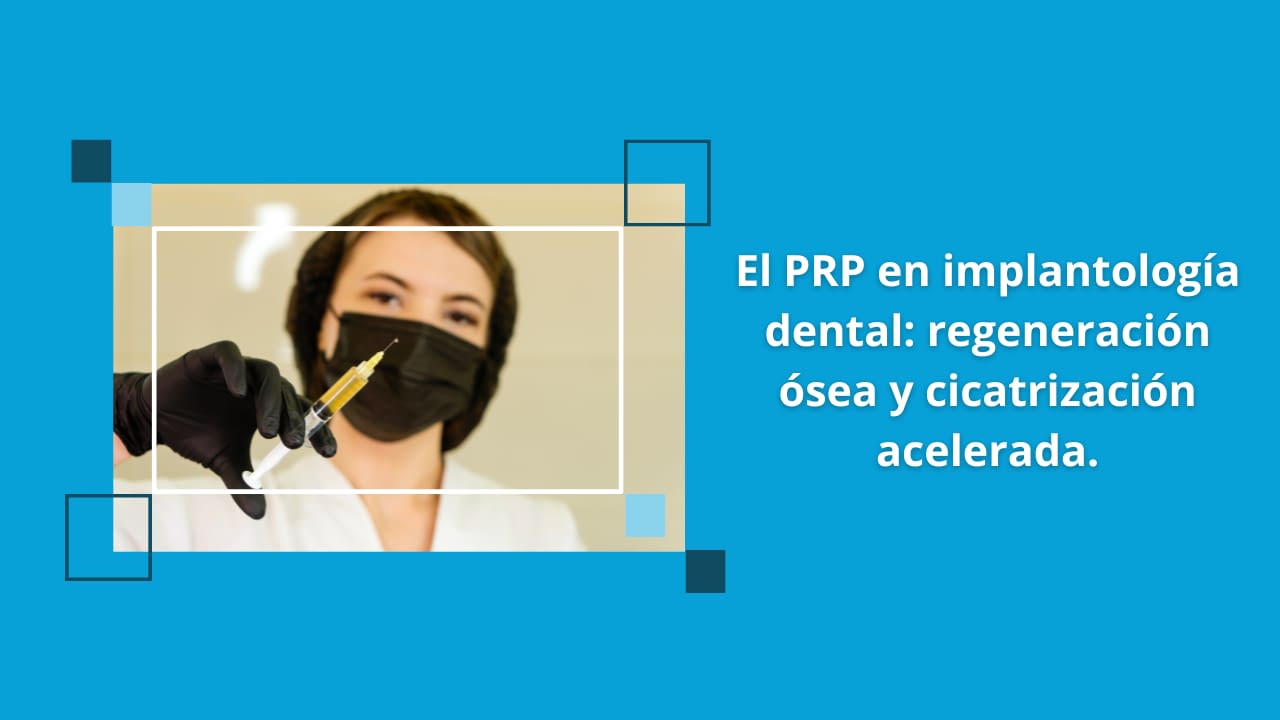 El PRP en implantología dental regeneración ósea y cicatrización acelerada
