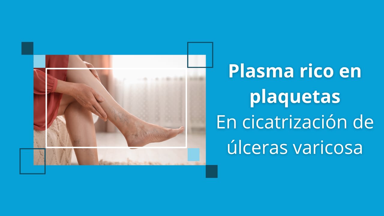 PRP en la cicatrización de úlceras varicosas