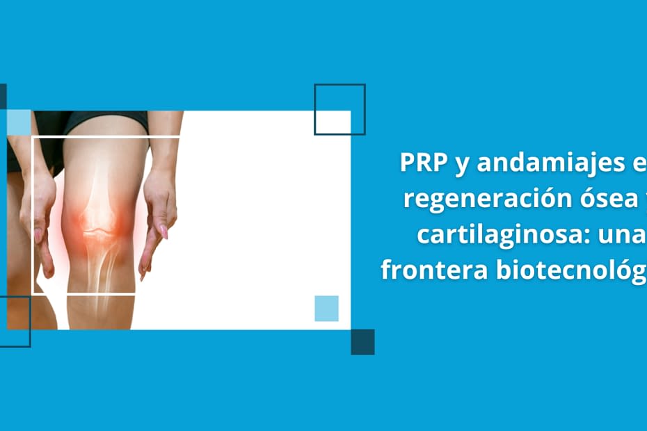 PRP y andamiajes en regeneración ósea y cartilaginosa: