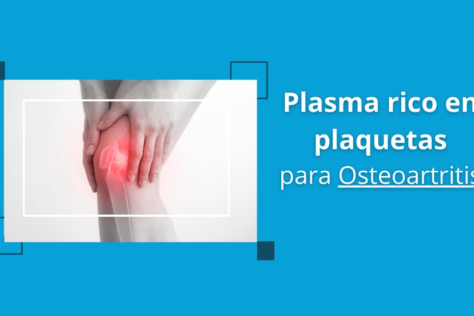 Plasma Rico en plaquetas para osteoartritis