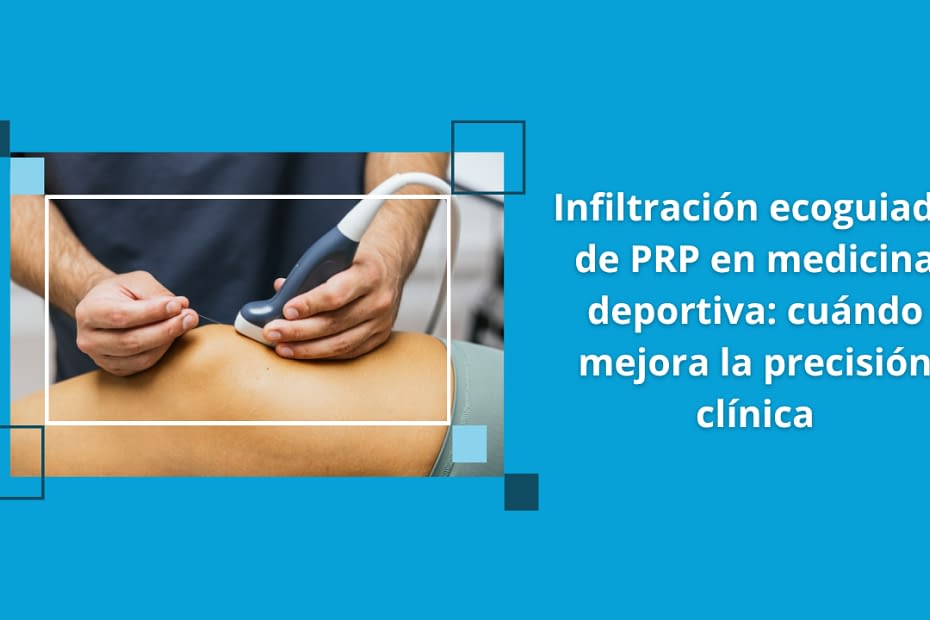 Infiltración ecoguiada de PRP en rodilla realizada con ecografía musculoesquelética