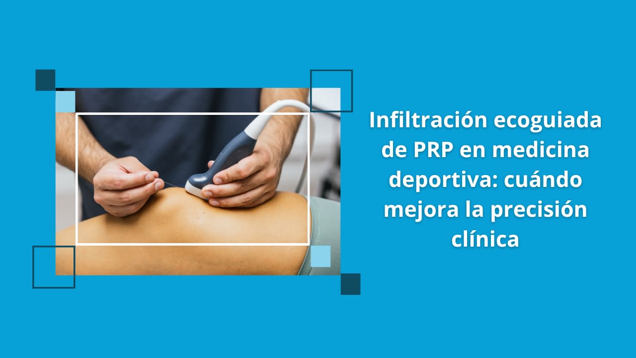 Infiltración ecoguiada de PRP en rodilla realizada con ecografía musculoesquelética