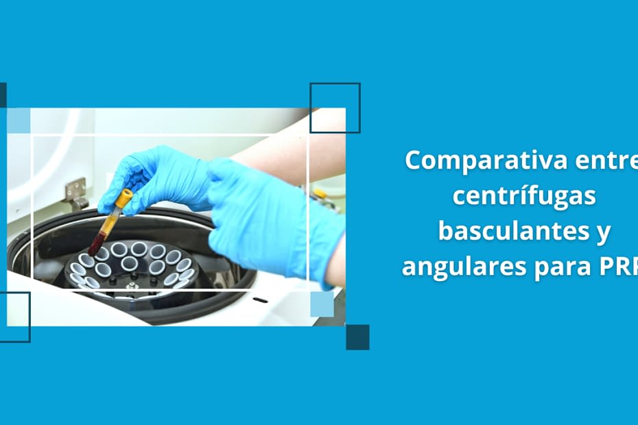 Centrífugas basculantes y angulares para PRP en procedimientos de medicina regenerativa