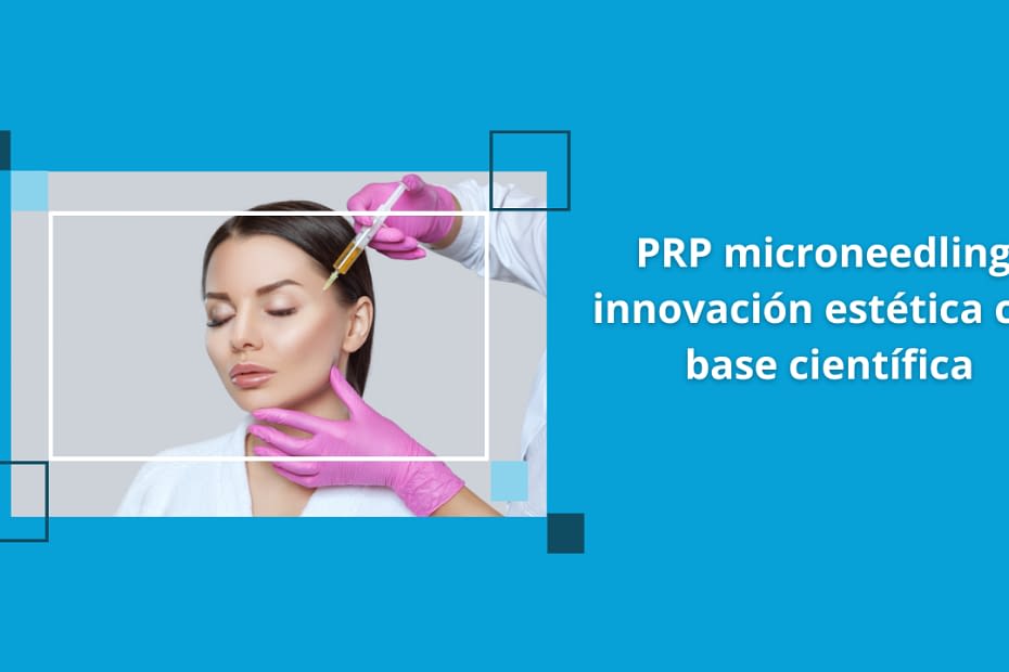 PRP microneedling innovación estética con base científica