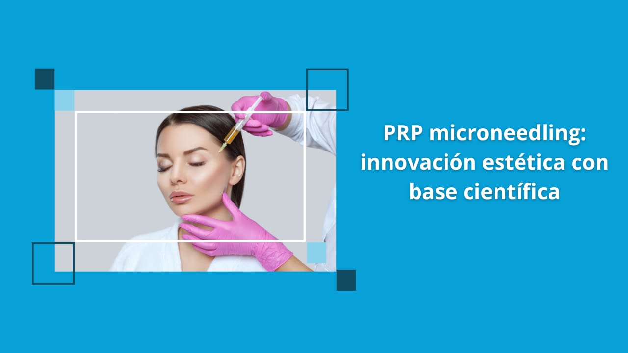 PRP microneedling innovación estética con base científica