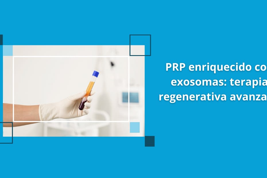PRP enriquecido con exosomas enn terapia regenerativa