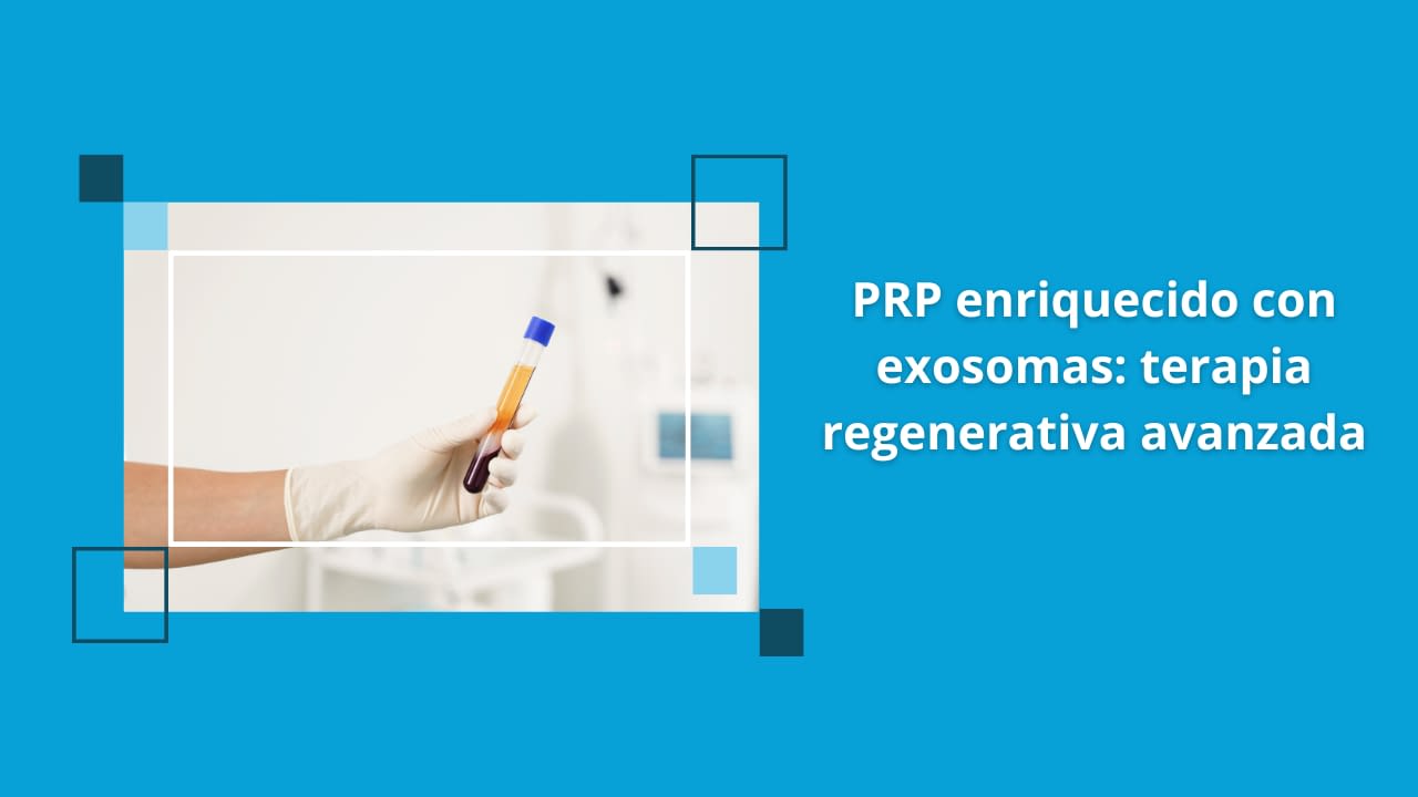 PRP enriquecido con exosomas enn terapia regenerativa