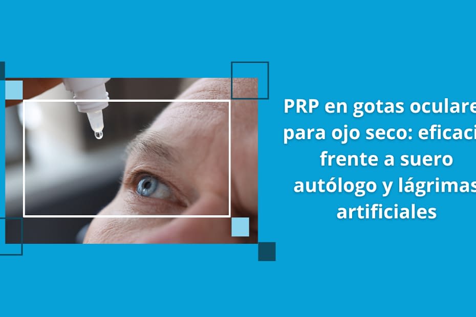 PRP en gotas oculares para ojo seco: eficacia frente a suero autólogo y lágrimas artificiales