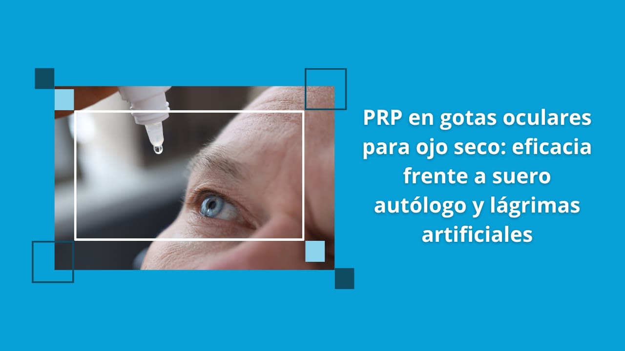 PRP en gotas oculares para ojo seco: eficacia frente a suero autólogo y lágrimas artificiales