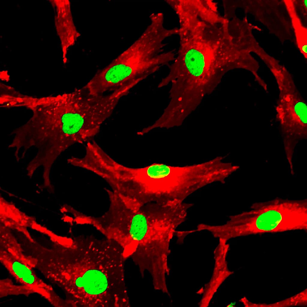 células mesenquimales en el microscopio