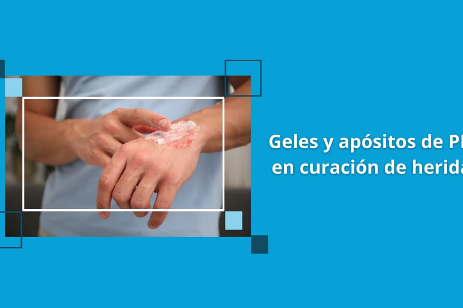 Geles y apósitos de PRP en curación de heridas