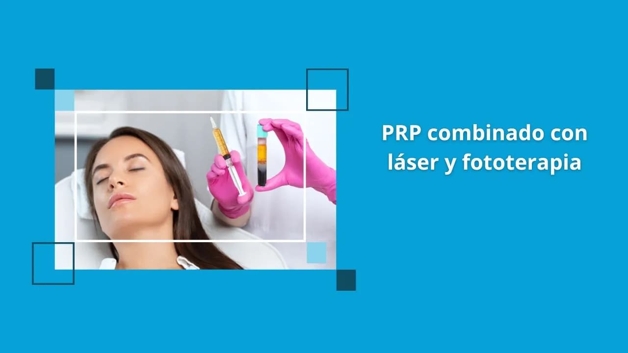 PRP combinado con láser y fototerapia