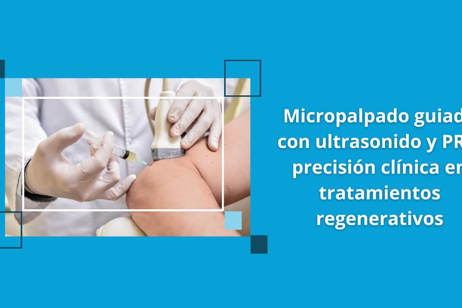 Micropalpado guiado con ultrasonido y PRP: precisión clínica en tratamientos regenerativos