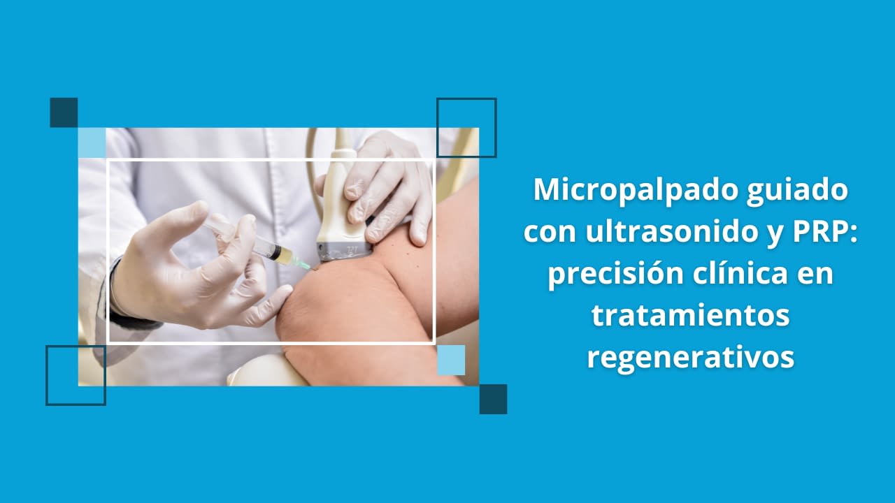 Micropalpado guiado con ultrasonido y PRP: precisión clínica en tratamientos regenerativos