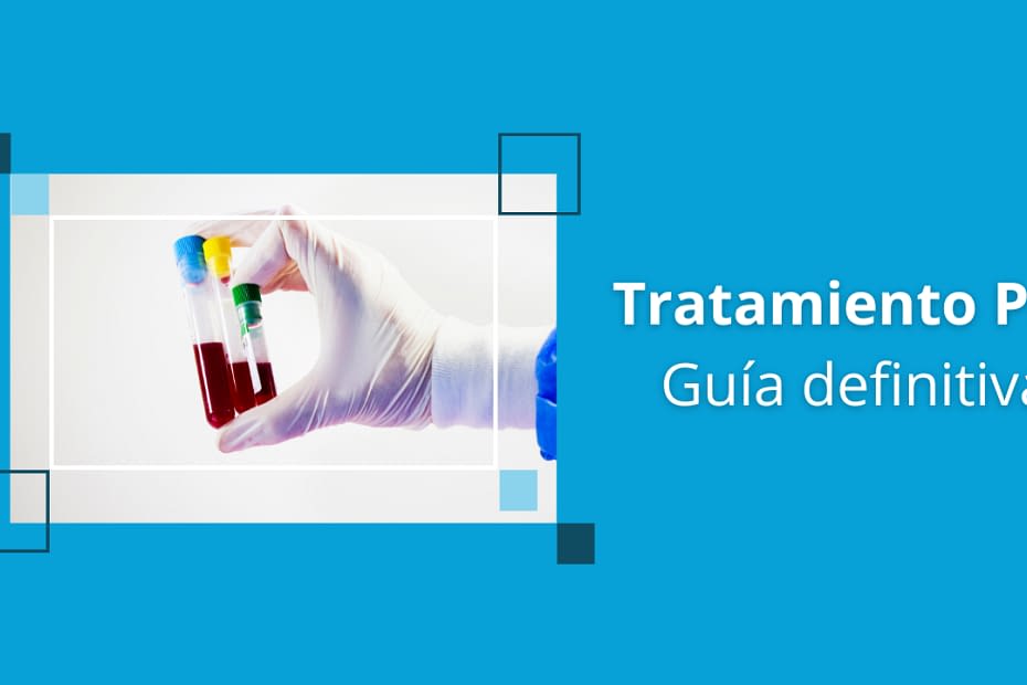 tratamiento prf la guia definitiva