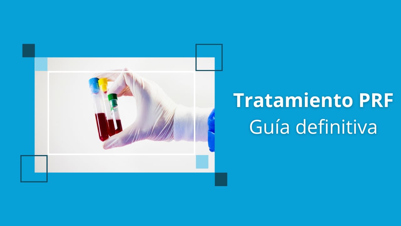 tratamiento prf la guia definitiva
