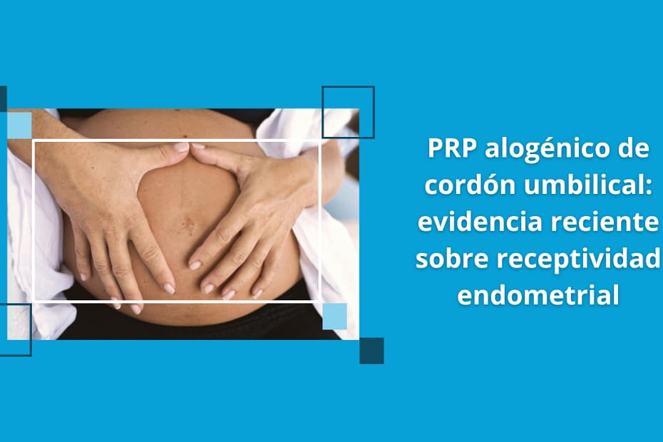 PRP alogénico de cordón umbilical aplicado en contexto clínico de reproducción asistida y receptividad endometrial.