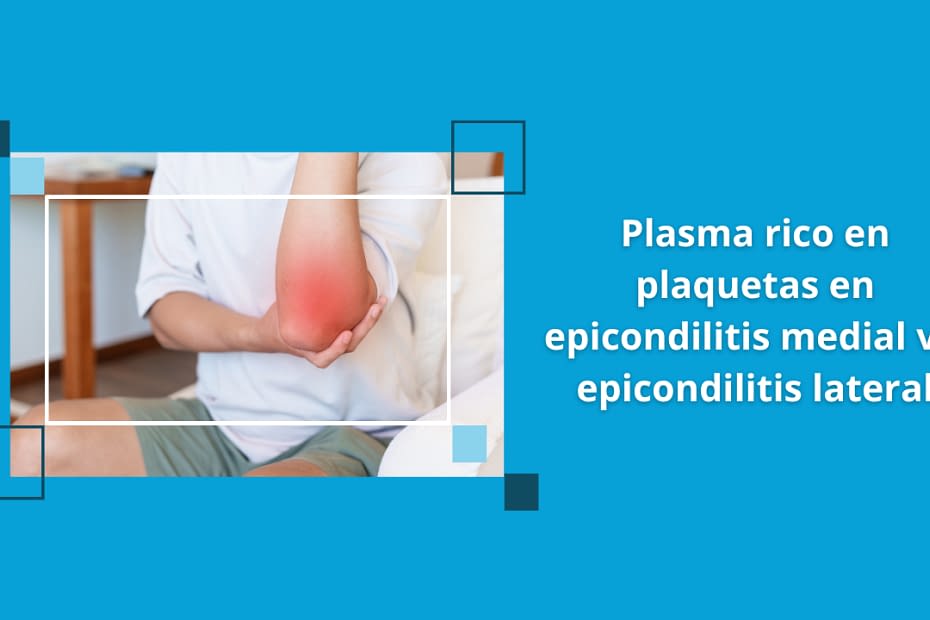 PRP en epicondilitis medial del codo