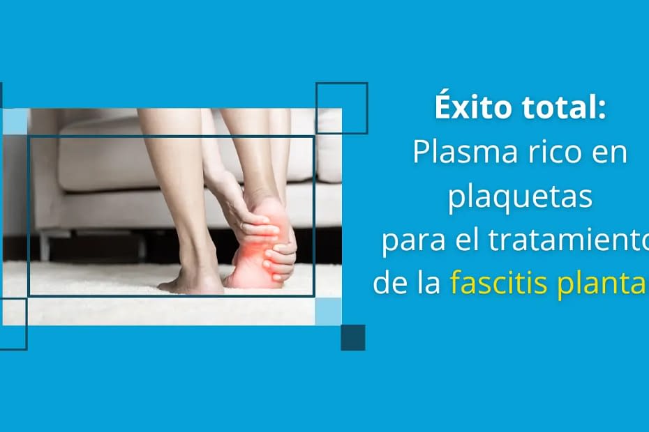 Plasma rico en plaquetas para el tratamiento de la fascitis plantar