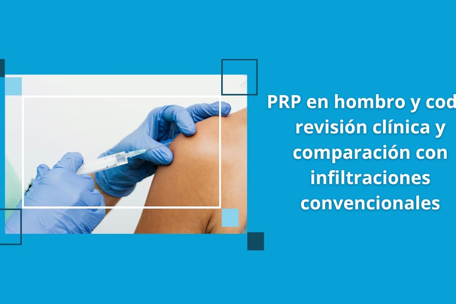 PRP en hombro y codo: revisión clínica y comparación con infiltraciones convencionales