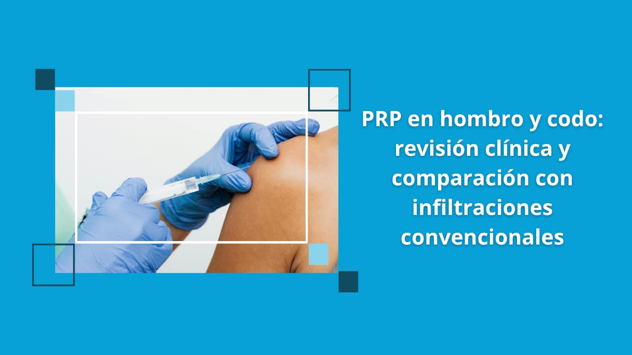 PRP en hombro y codo: revisión clínica y comparación con infiltraciones convencionales